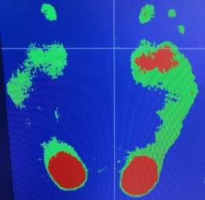足の重心測定